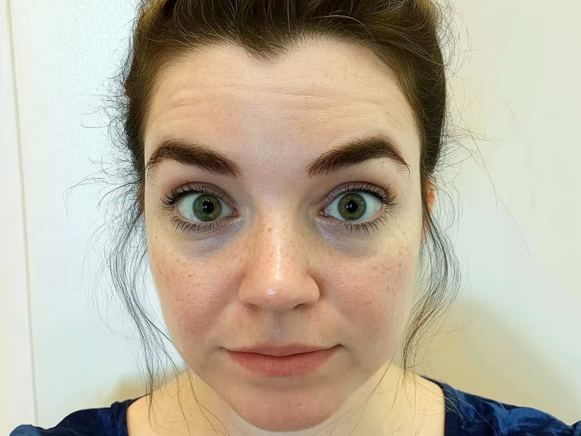 The Truth About Dark Circles: Why “Bad Sleep” Isn’t the Real Culprit (And How to Fix Them) The Truth About Dark Circles: Why “Bad Sleep” Isn’t the Real Culprit (And How to Fix Them)