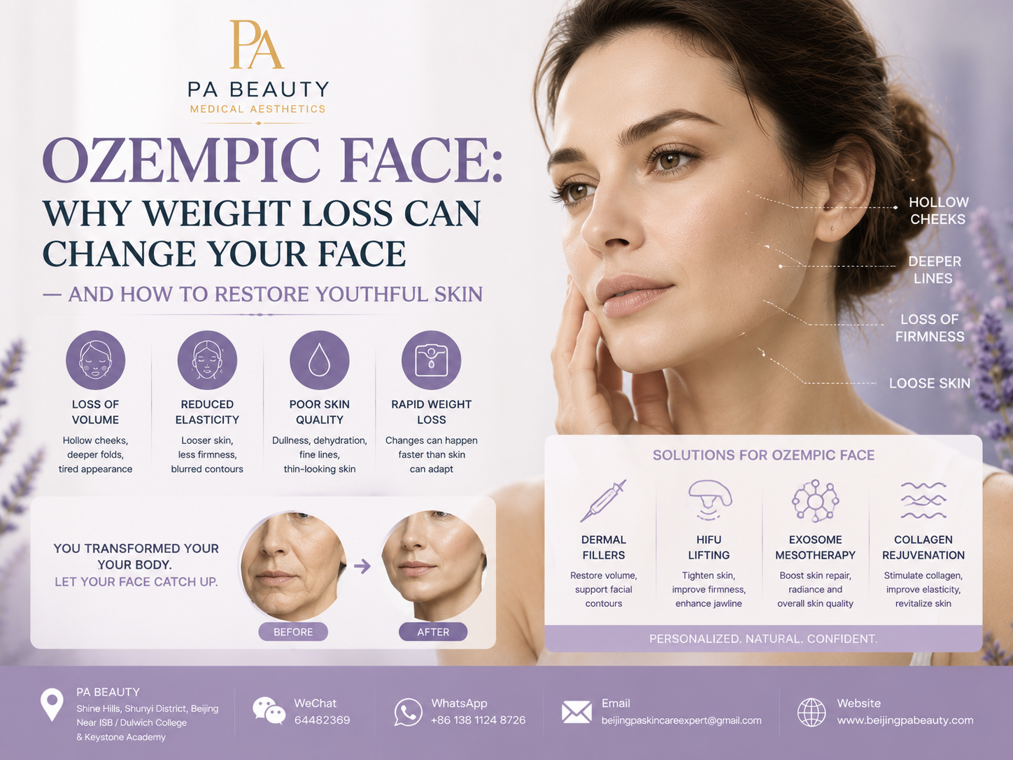 Ozempic Face: Why Weight Loss Changes Your Face & How to Restore Youthful Skin 