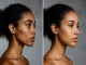  Acne & Dark Spots: Why Your "Anti-Acne" Routine Might Be Causing More Damage
