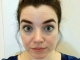 The Truth About Dark Circles: Why “Bad Sleep” Isn’t the Real Culprit (And How to Fix Them)