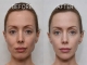 Tired of the "Lopsided" Look? How to Fix Asymmetry & Slim Your Jaw