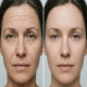 Botox Myths Busted: The Truth About Anti-Wrinkle Treatments at PA BEAUTY