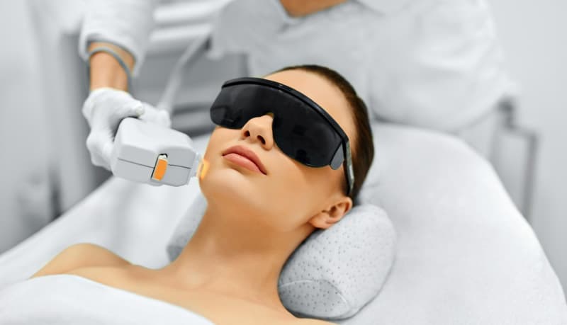 ipl-laser